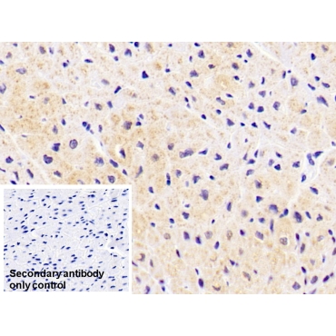 Aspartate Aminotransferase 2 (AST2) Human Monoclonal Antibody