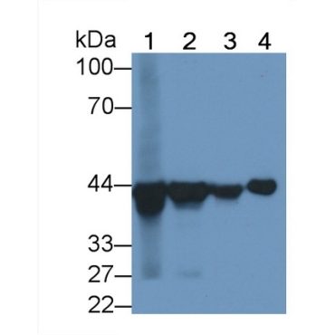 Aspartate Aminotransferase 2 (AST2) Human Monoclonal Antibody