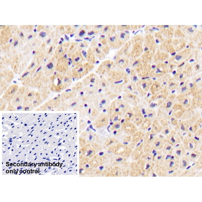 Aspartate Aminotransferase 2 (AST2) Human Monoclonal Antibody