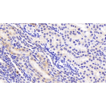 Aspartate Aminotransferase 2 (AST2) Human Monoclonal Antibody