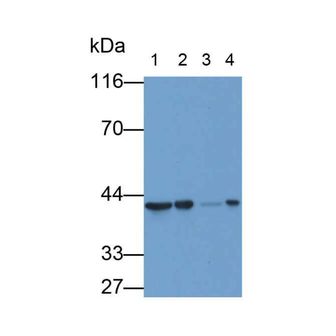 Aspartate Aminotransferase 2 (AST2) Human Monoclonal Antibody