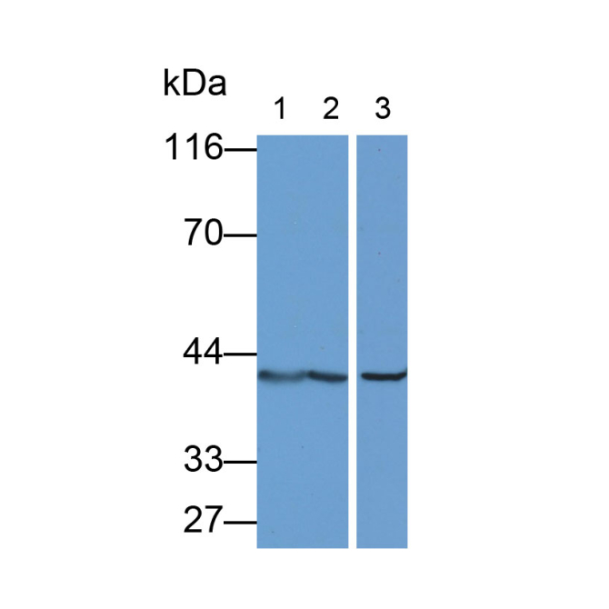 Aspartate Aminotransferase 2 (AST2) Human Monoclonal Antibody