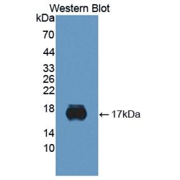 Sialic Acid Binding Ig Like Lectin 10 (SIGLEC10) Human Monoclonal Antibody