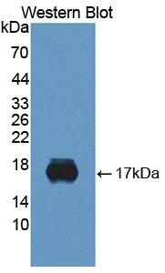 Sialic Acid Binding Ig Like Lectin 10 (SIGLEC10) Human Monoclonal Antibody