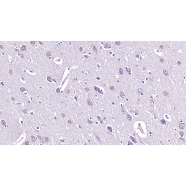 Sialic Acid Binding Ig Like Lectin 10 (SIGLEC10) Human Monoclonal Antibody