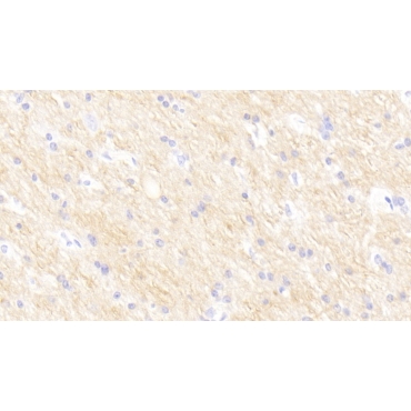 Sialic Acid Binding Ig Like Lectin 9 (SIGLEC9) Human Monoclonal Antibody