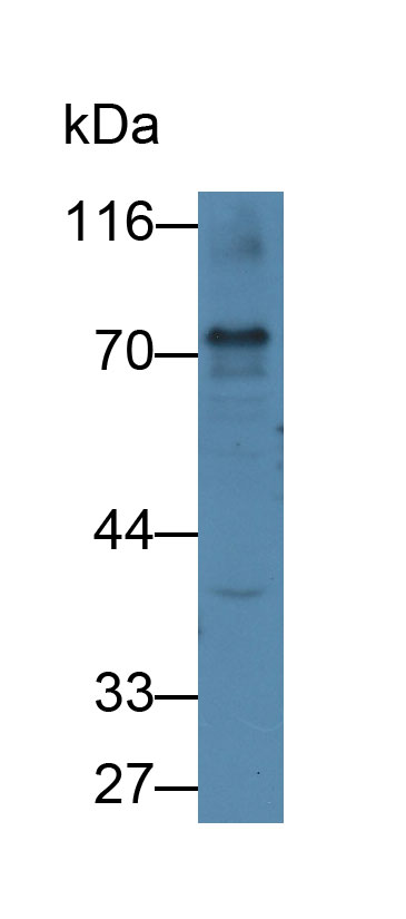 Proprotein Convertase Subtilisin/Kexin Type 9 (PCSK9) Rat Monoclonal Antibody