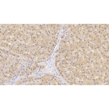 4-Hydroxyphenylpyruvate Dioxygenase (HPD) Human Monoclonal Antibody