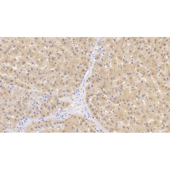 4-Hydroxyphenylpyruvate Dioxygenase (HPD) Human Monoclonal Antibody