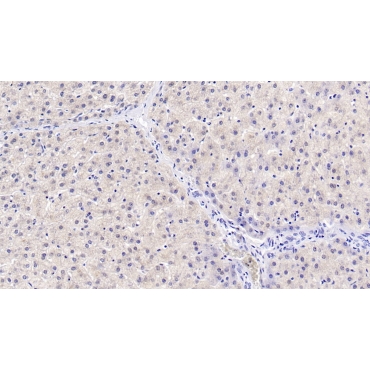 4-Hydroxyphenylpyruvate Dioxygenase (HPD) Human Monoclonal Antibody