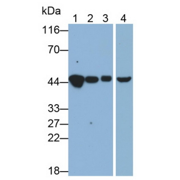 4-Hydroxyphenylpyruvate Dioxygenase (HPD) Human Monoclonal Antibody