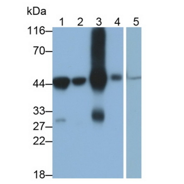 4-Hydroxyphenylpyruvate Dioxygenase (HPD) Human Monoclonal Antibody
