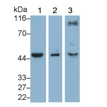 4-Hydroxyphenylpyruvate Dioxygenase (HPD) Human Monoclonal Antibody