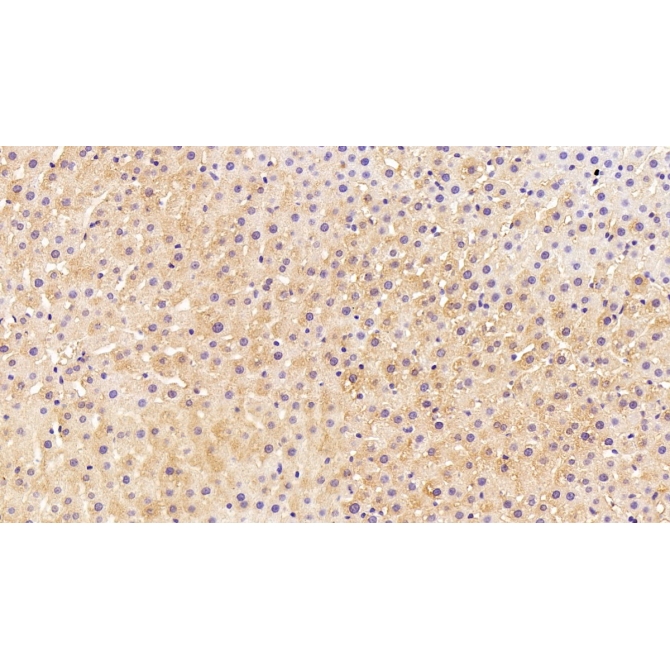 4-Hydroxyphenylpyruvate Dioxygenase (HPD) Human Monoclonal Antibody