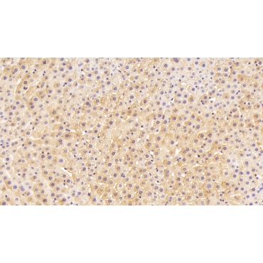 4-Hydroxyphenylpyruvate Dioxygenase (HPD) Human Monoclonal Antibody