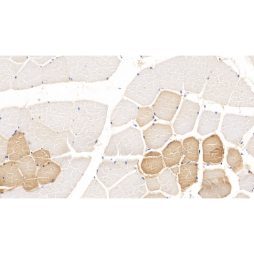 Tryptophan-2,3-dioxygenase (TDO) Human Monoclonal Antibody