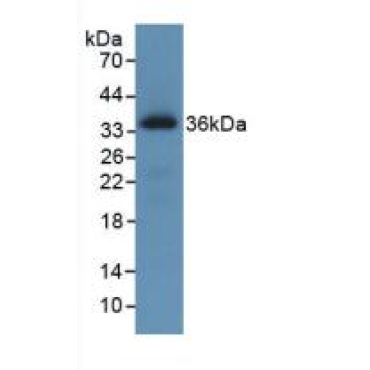 C-Ros Oncogene 1, Receptor Tyrosine Kinase (ROS1) Human Monoclonal Antibody