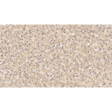 C-Ros Oncogene 1, Receptor Tyrosine Kinase (ROS1) Human Monoclonal Antibody