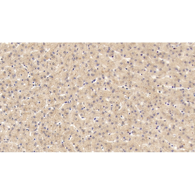 C-Ros Oncogene 1, Receptor Tyrosine Kinase (ROS1) Human Monoclonal Antibody