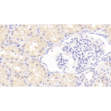 Urea Transporter, Erythrocyte (UTE) Human Monoclonal Antibody