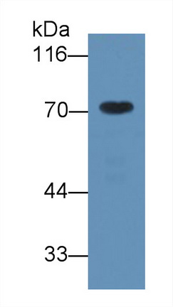 Alpha-1-B-Glycoprotein (a1BG) Human Monoclonal Antibody