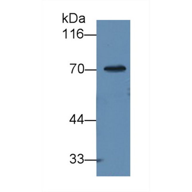 Alpha-1-B-Glycoprotein (a1BG) Human Monoclonal Antibody