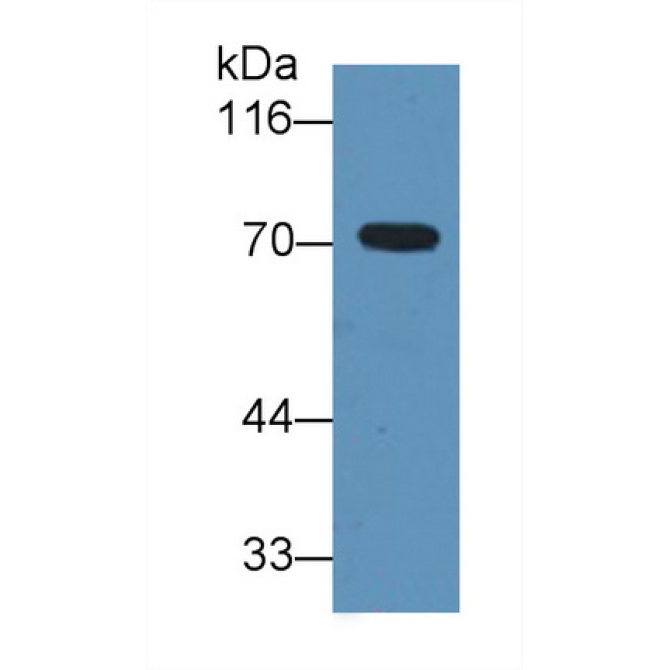 Alpha-1-B-Glycoprotein (a1BG) Human Monoclonal Antibody