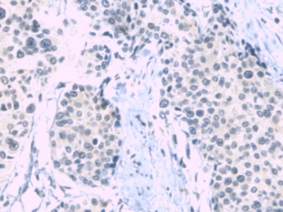 Alpha-1-B-Glycoprotein (a1BG) Human Monoclonal Antibody