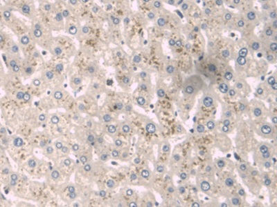 Alpha-1-B-Glycoprotein (a1BG) Human Monoclonal Antibody