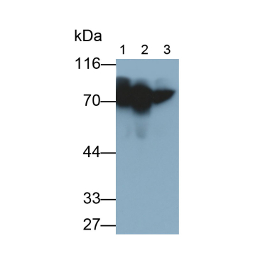 Alpha-1-B-Glycoprotein (a1BG) Human Monoclonal Antibody