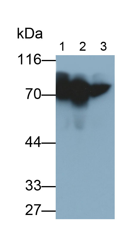 Alpha-1-B-Glycoprotein (a1BG) Human Monoclonal Antibody