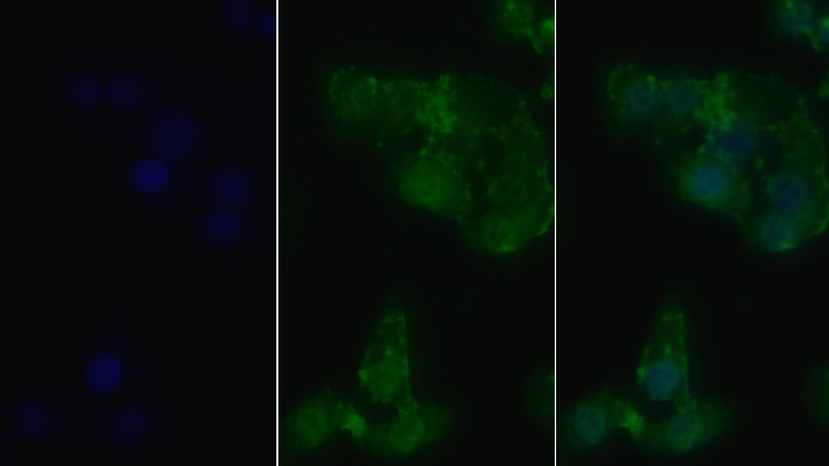 Receptor Interacting Serine Threonine Kinase 1 (RIPK1) Human Monoclonal Antibody