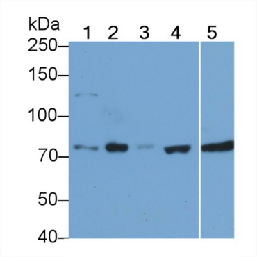 Receptor Interacting Serine Threonine Kinase 1 (RIPK1) Human Monoclonal Antibody