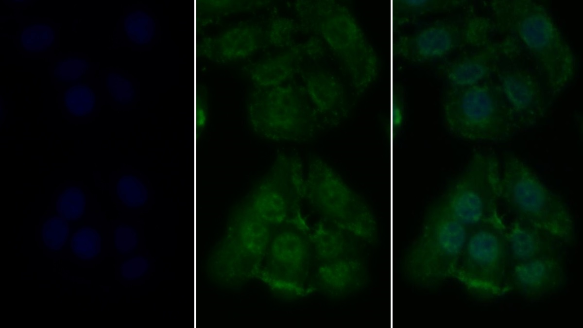 Receptor Interacting Serine Threonine Kinase 1 (RIPK1) Human Monoclonal Antibody