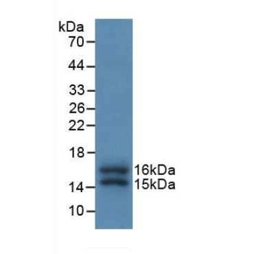 FK506 Binding Protein 1A (FKBP1A) Human Monoclonal Antibody