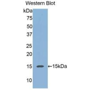 Regenerating Islet Derived Protein 3 Alpha (REG3a) Human Monoclonal Antibody
