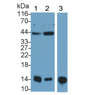Regenerating Islet Derived Protein 3 Gamma (REG3g) Human Monoclonal Antibody
