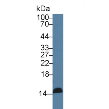 Regenerating Islet Derived Protein 3 Gamma (REG3g) Human Monoclonal Antibody