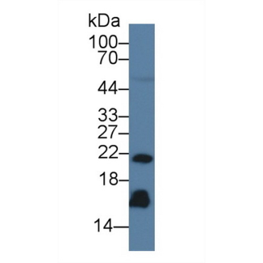 Regenerating Islet Derived Protein 3 Gamma (REG3g) Human Monoclonal Antibody
