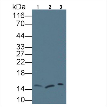 Regenerating Islet Derived Protein 3 Gamma (REG3g) Human Monoclonal Antibody