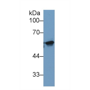 Karyopherin Alpha 2 (KPNa2) Human Monoclonal Antibody