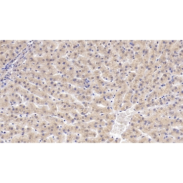 Karyopherin Alpha 2 (KPNa2) Human Monoclonal Antibody
