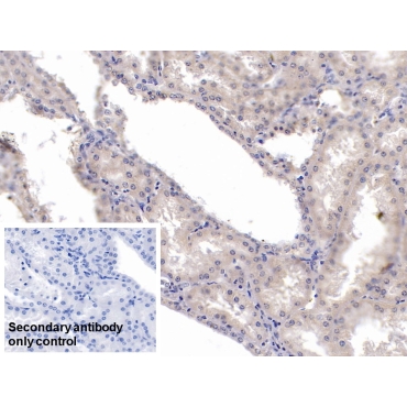 Karyopherin Alpha 2 (KPNa2) Human Monoclonal Antibody