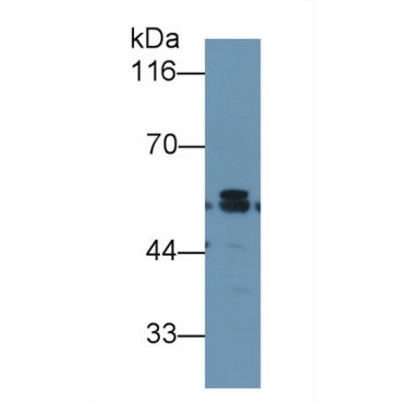 Karyopherin Alpha 2 (KPNa2) Human Monoclonal Antibody