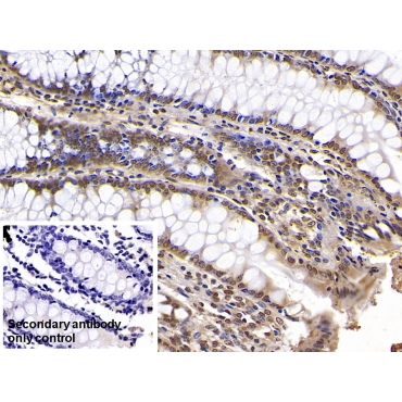 Karyopherin Alpha 2 (KPNa2) Human Monoclonal Antibody