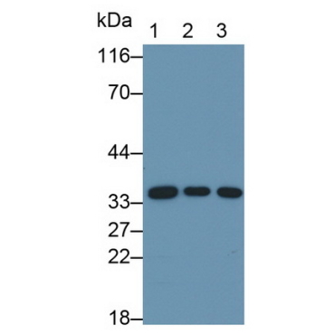 Annexin A4 (ANXA4) Human Monoclonal Antibody