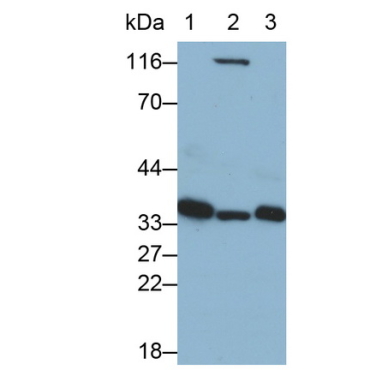 Annexin A4 (ANXA4) Human Monoclonal Antibody