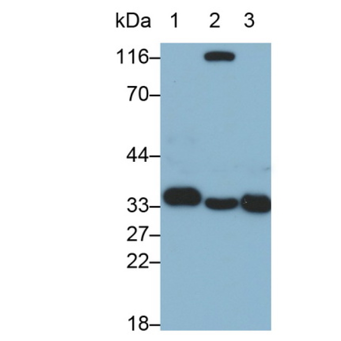 Annexin A4 (ANXA4) Human Monoclonal Antibody