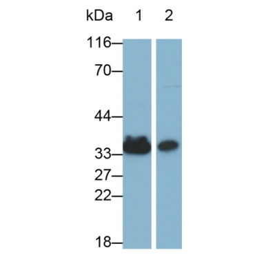 Annexin A4 (ANXA4) Human Monoclonal Antibody