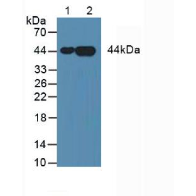 Annexin A3 (ANXA3) Human Monoclonal Antibody